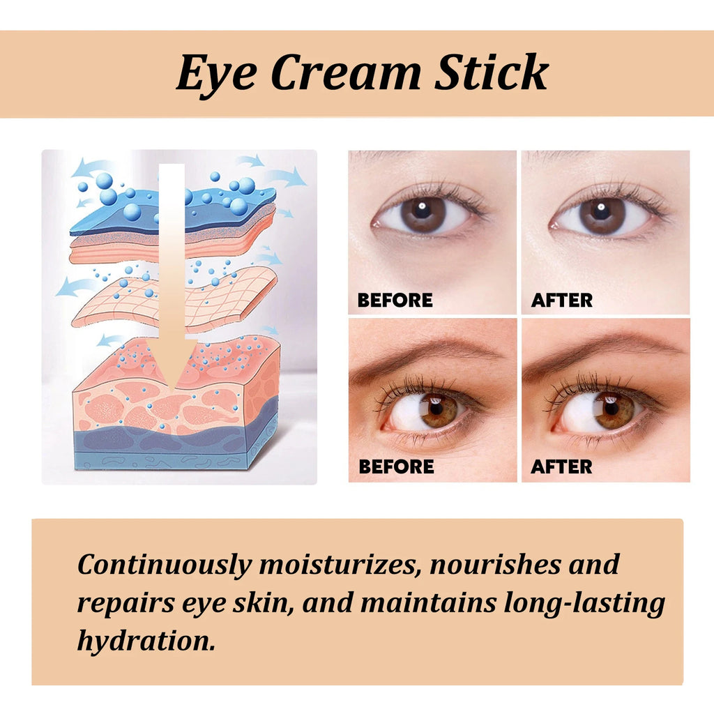 Stick Creme Anti-Olheiras Caracol — Colágeno + Hidratação
